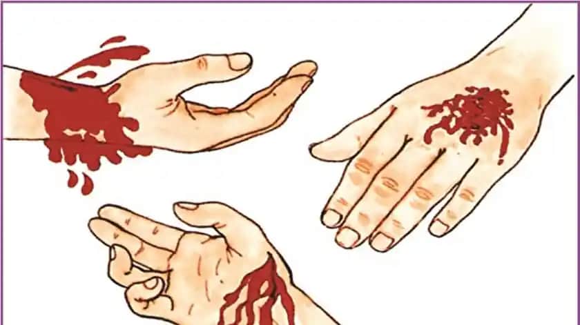 Deri Kavlaması ve Kozmetik Bakım Yöntemleri: Cilt Sağlığını Koruma Rehberi