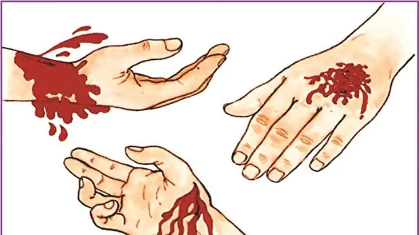 Deri Kavlaması ve Kozmetik Bakım Yöntemleri: Cilt Sağlığını Koruma Rehberi