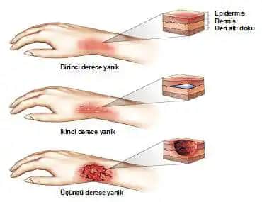 Deri Tahrişi ve Güvenli Kozmetik Kullanımı: Sağlıklı Cilt İçin Bilinmesi Gerekenler