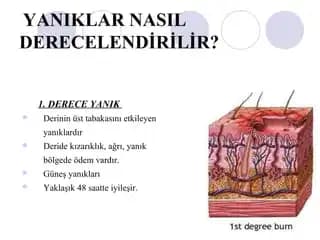 Deri Yanıkları ve Kızarıklıklar: Kozmetik Yaklaşımlar ve Etkili Bakım Yöntemleri