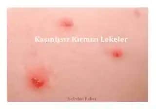 Derideki Kir ve Lekelerin Nedenleri ve Etkili Bakım Yöntemleri Hakkında Kapsamlı Rehber