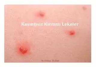 Derideki Kir ve Lekelerin Nedenleri ve Etkili Bakım Yöntemleri Hakkında Kapsamlı Rehber