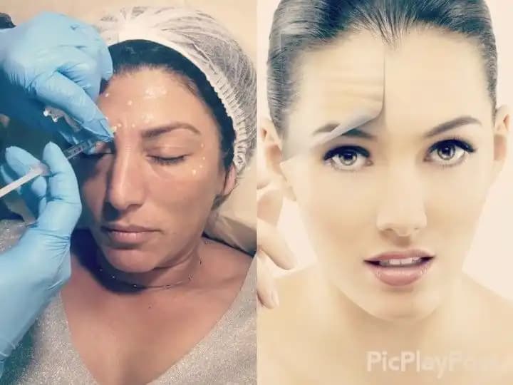 Derin Alın Kırışıklıkları Nedenleri ve Etkili Tedavi Yöntemleri Analizi