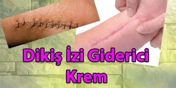 Diken İzi Nedir, Nasıl Azaltılır ve Kozmetik Yöntemlerle Gelişmiş Çözümler