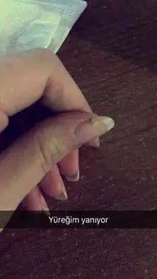 Dikenli ve Kırılan Tırnaklar: Sağlıklı ve Güçlü Tırnaklar İçin Bilmeniz Gerekenler