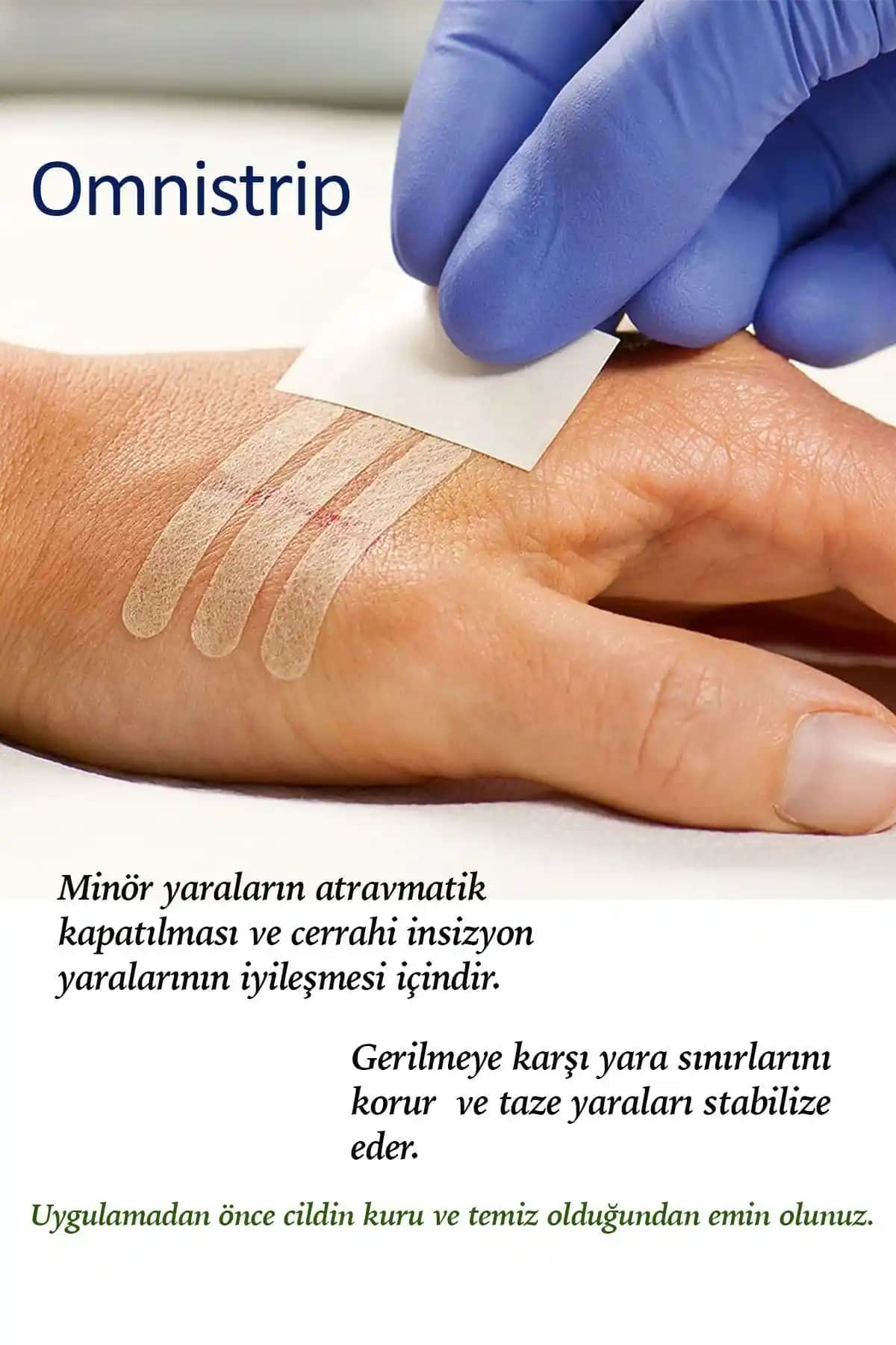 Dikiş Bandı Kullanımı ve Kalma Süresi Hakkında Bilmeniz Gerekenler