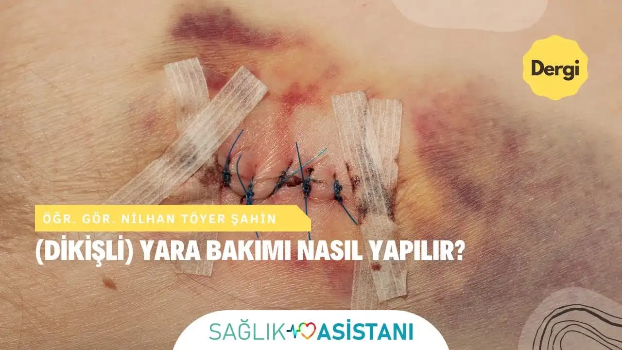 Dikiş Tutmayan Yaraların Tedavisi ve İyileşme Sürecinde Dikkat Edilmesi Gerekenler