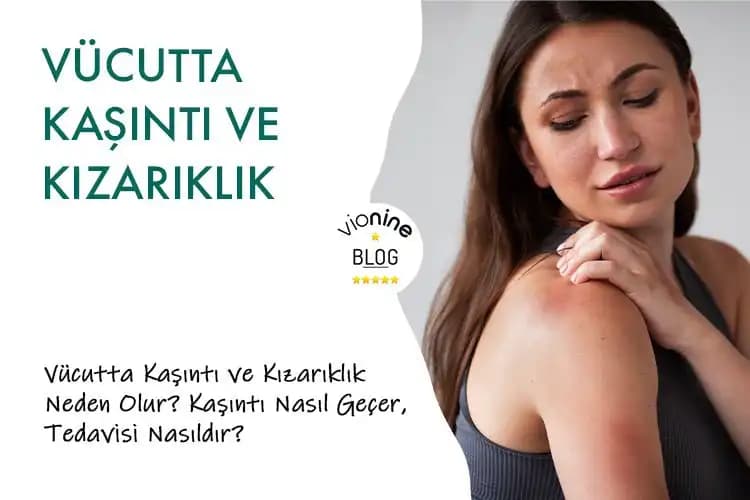 Dikiş Yerinde Kızarıklık Nedenleri ve Sağlıklı İyileşme İçin Öneriler