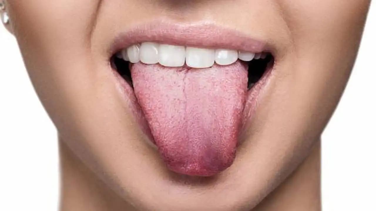 Dil Çatlaklarının Nedenleri, Bakım Yöntemleri ve Doğal Çözüm Tavsiyeleri