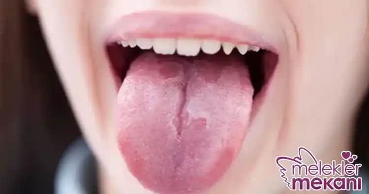 Dil Kesiklerinin Nedenleri ve Korunma Yolları Hakkında Kapsamlı Bilgi