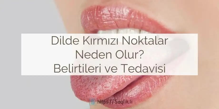 Dil Üzerinde Kırmızı Leke Nedenleri ve Sağlık ile Güzellik Arasındaki Denge