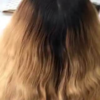 Dipteki Turunculuğu Giderme Yöntemleri ve Cilt Sağlığına Yeni Yaklaşımlar