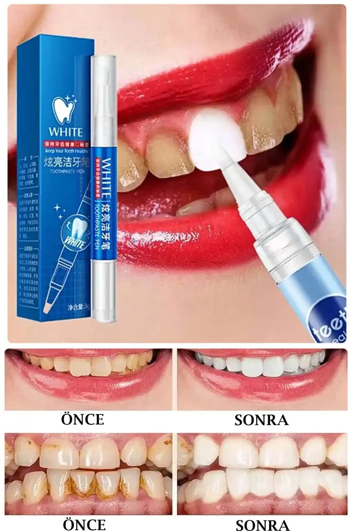 Diş Beyazlatma Jeli: Güzel ve Sağlıklı Bir Gülüş İçin Etkili Kozmetik Ürünleri