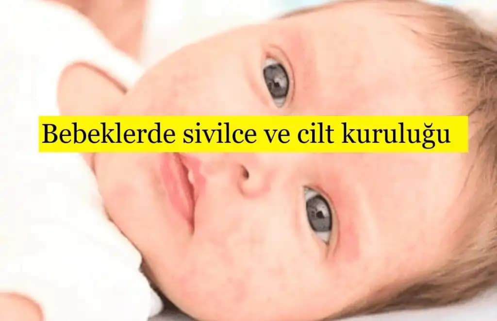 Doğum Sonrası Cilt Kuruluğu ve Koruma Yöntemleri Rehberi