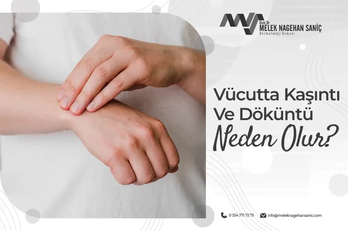 Döküntü Nedir ve Kozmetik Perspektiften Nasıl Anlaşılır