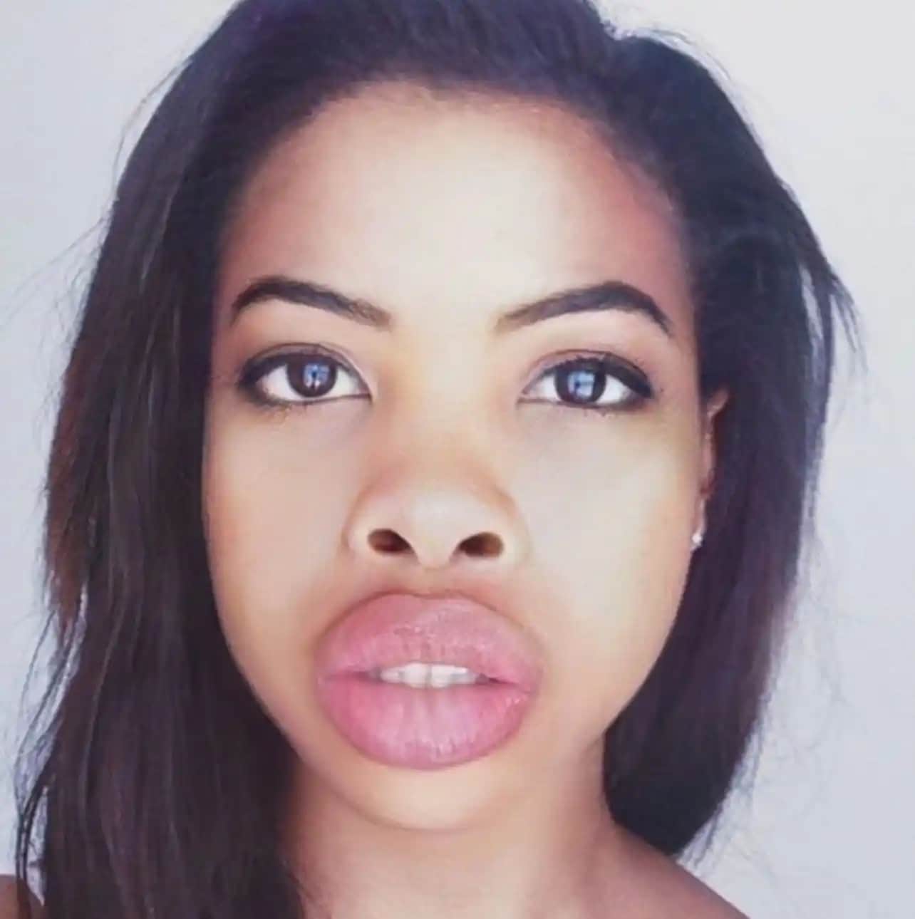 Dudak Estetiği ve Doğal Yollarla Dolgunluk Sağlama Yöntemleri