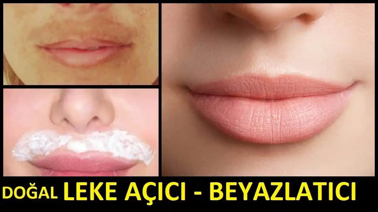 Dudak Üstü Beyazlığı Nedenleri ve Doğal Çözüm Yolları Hakkında Kapsamlı Rehber