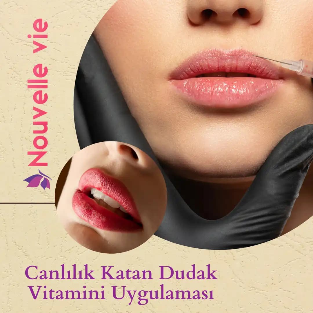 Dudak Vitamini Uygulamalarında Kalıcılık ve Bakım İpuçları