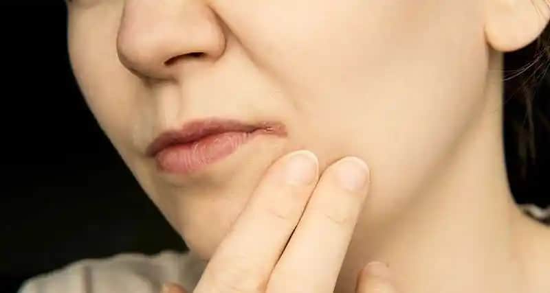 Dudakta Kaşıntı Nedenleri Belirtileri ve Etkili Çözüm Yöntemleri