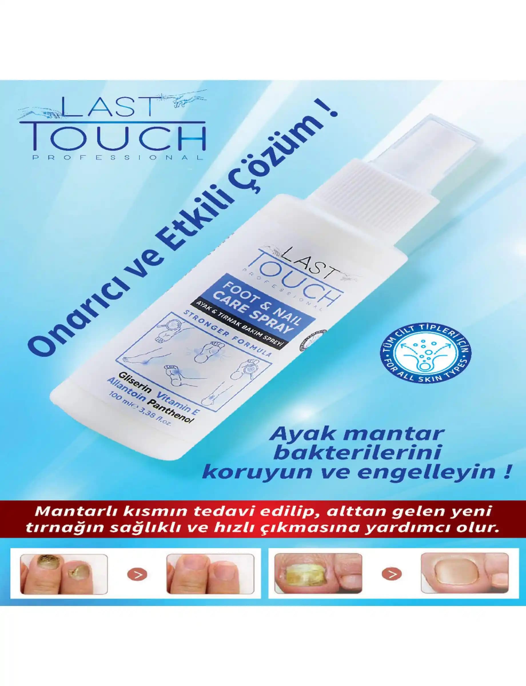 Eczaneden Satılan Tırnak Mantarı Spreyleri: Kullanım İpuçları ve Etkili Çözümler