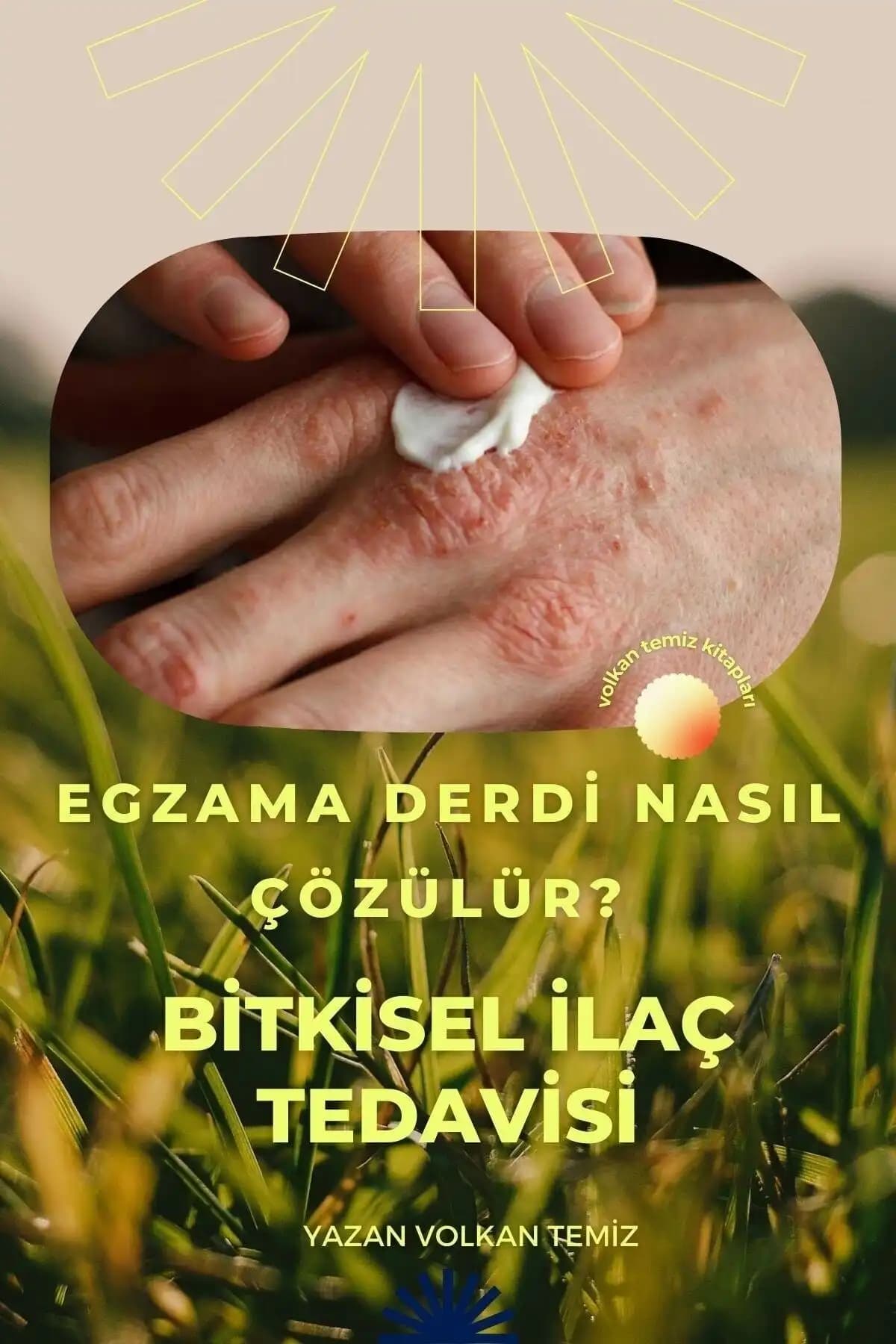 Egzama iğne tedavisi: Kozmetik ve cilt sağlığında yeni umutlar ve uygulama yöntemleri