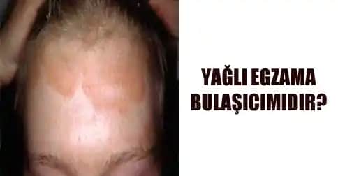 Egzama ile Mücadelede Doğru Kozmetik Seçimi ve Cilt Bakım İpuçları