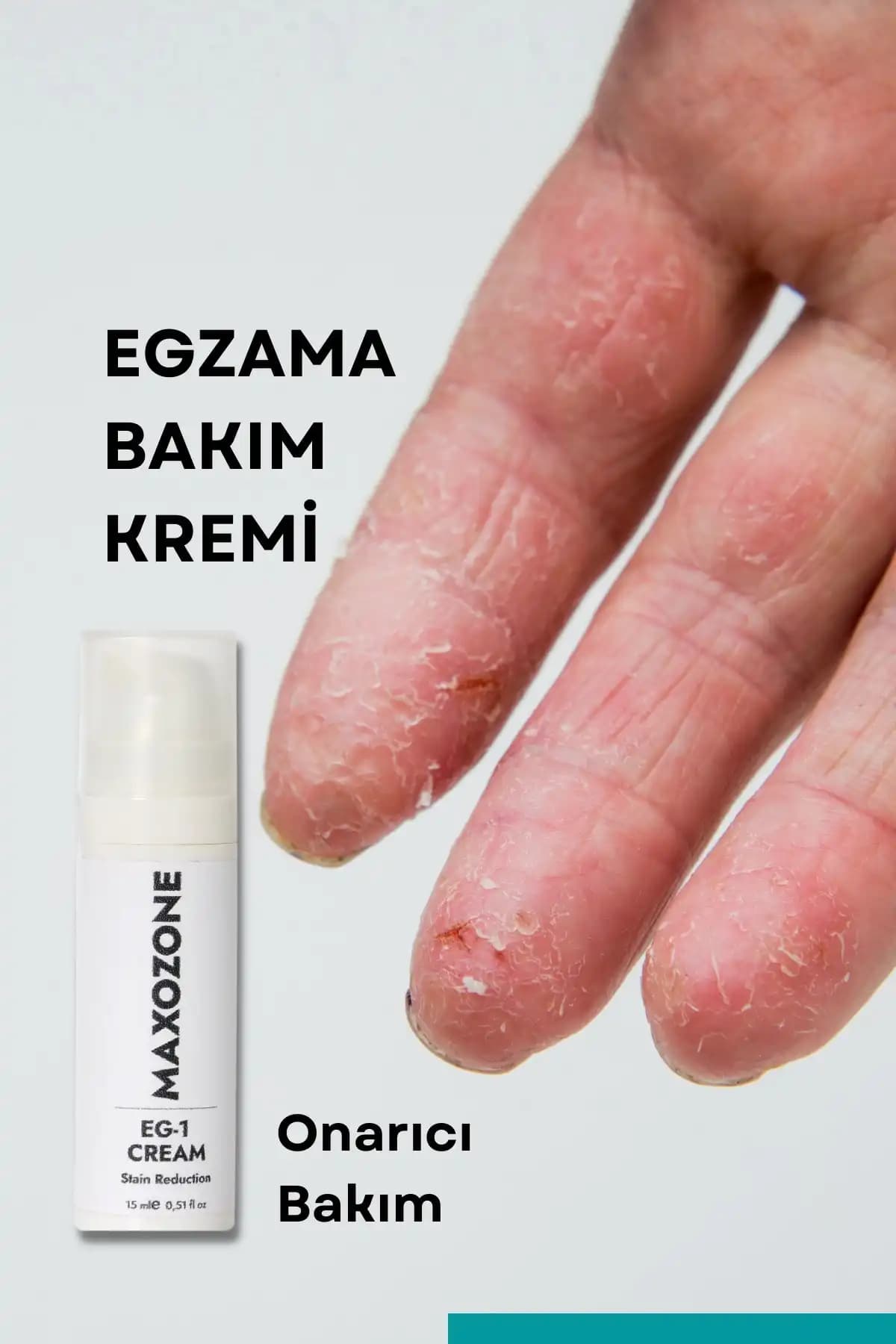 Egzama Kremi Seçimi ve Cilt Sağlığı İçin Doğru Yaklaşımlar Rehberi