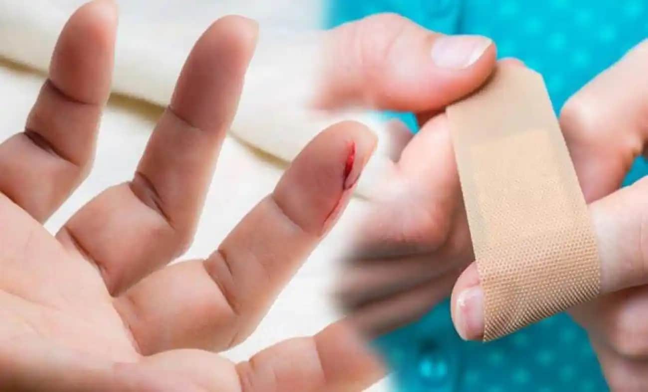 El Kesiği Nasıl İyileşir ve Enfeksiyon Riskini Nasıl Azaltılır