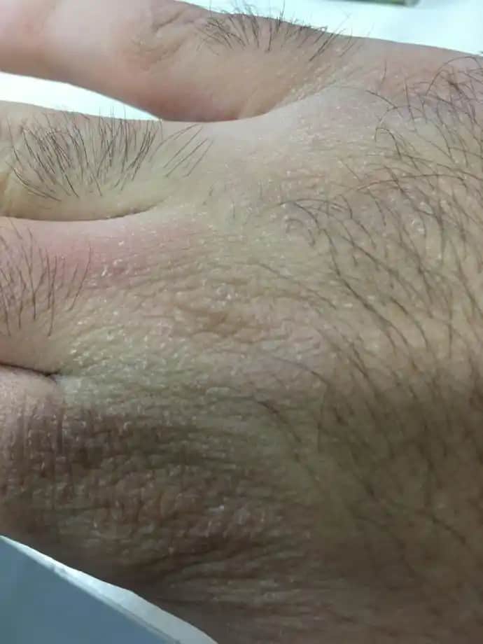 El Kuruluğu Nedenleri ve Etkili Bakım Yöntemleri Hakkında Kapsamlı Rehber