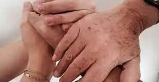 El Üstü Kararma Nedenleri ve Önleme Yöntemleri Hakkında Detaylı Bilgi