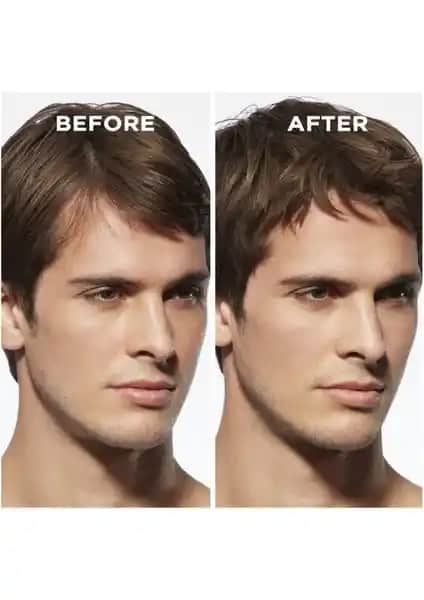 Erkekler İçin Saç Kalınlaştırıcılar: Güvenilir ve Etkili Yöntemler Hakkında Kapsamlı Rehber