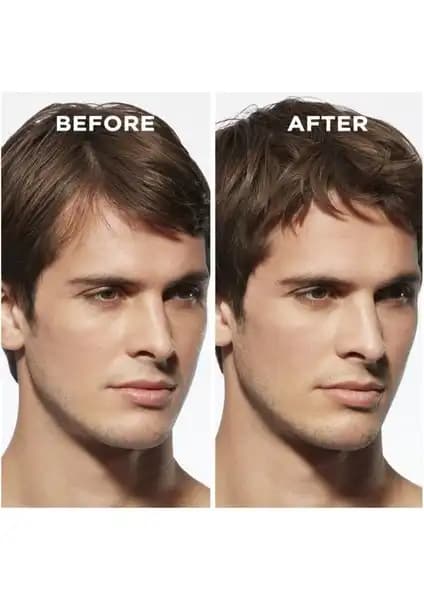 Erkekler İçin Saç Kalınlaştırıcılar: Güvenilir ve Etkili Yöntemler Hakkında Kapsamlı Rehber