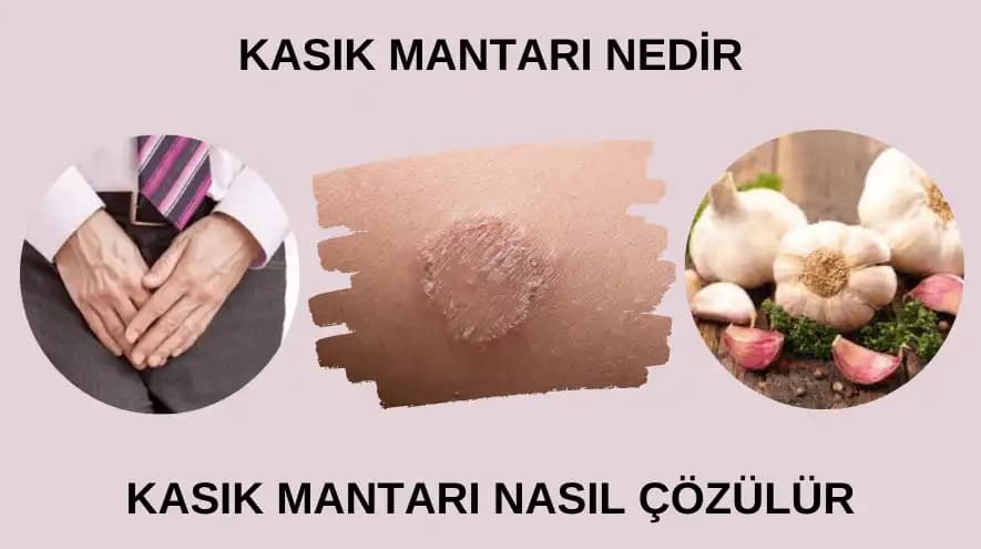 Erkeklerde Bacak Arası Kararması Nedenleri ve Etkili Çözüm Yolları