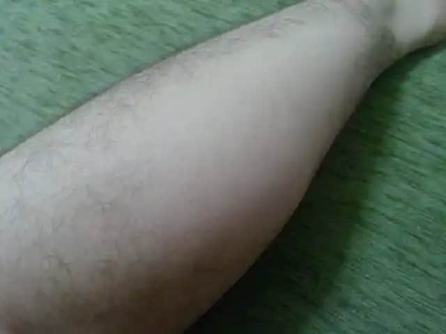 Erkeklerde Bacaklarda Kıl Dökülmesinin Nedenleri ve Çözüm Yolları Analizi