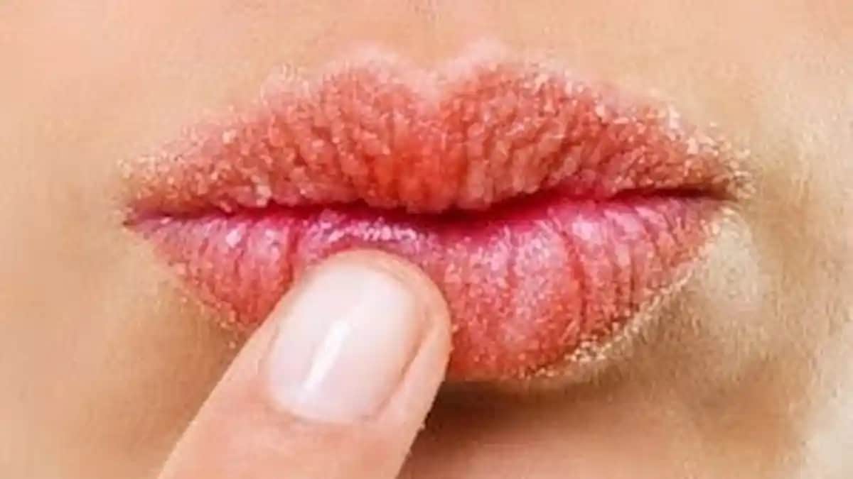Evde Dudak Peelingi ile Pürüzsüz ve Sağlıklı Dudaklara Ulaşma Yöntemleri