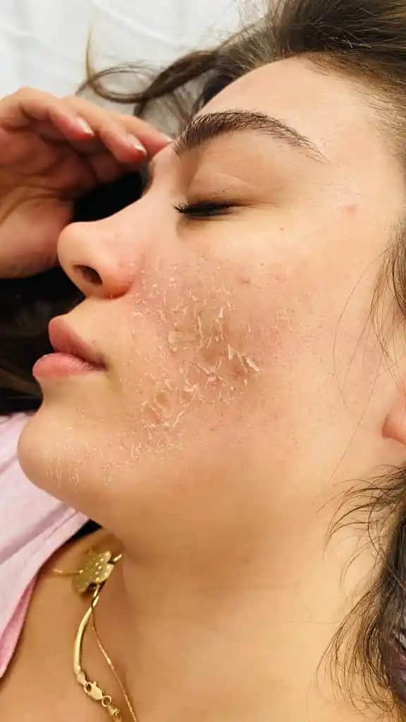 Evde Yosun Peeling ile Doğal Güzellik ve Cilt Sağlığına Katkı Sağlama Rehberi