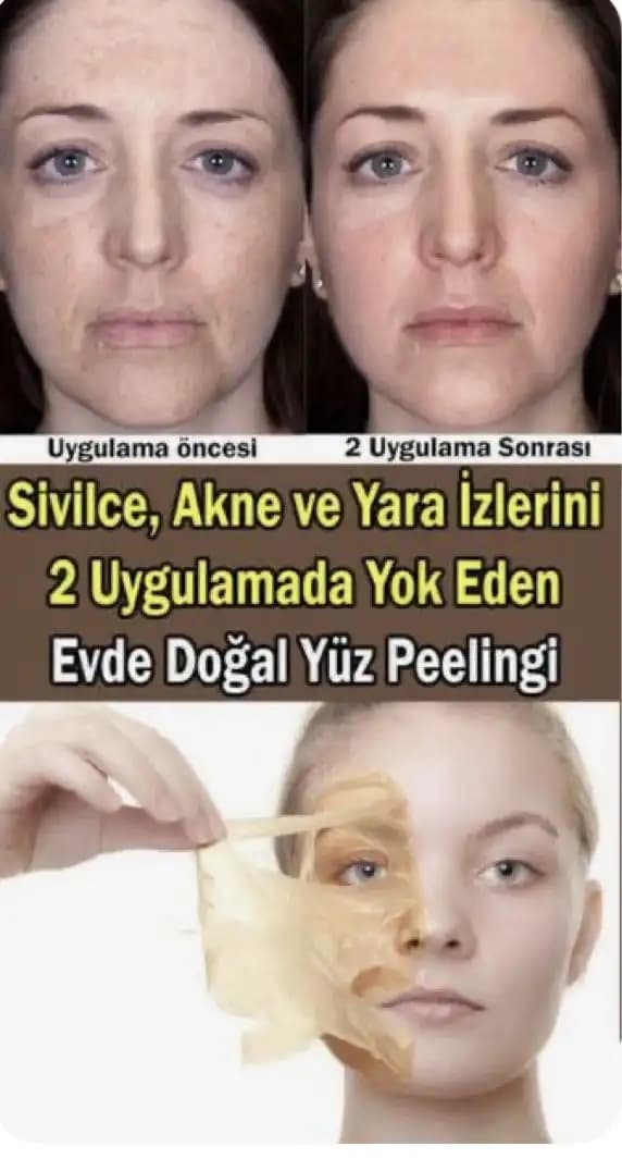 Evde Yüz Peelingi Rehberi: Sağlıklı ve Parlak Cilt İçin Adım Adım Uygulama