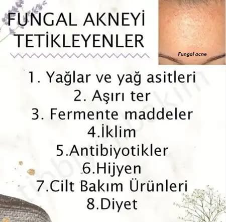 Fungal Akne Nedir ve Evde Doğal Tedavi Yöntemleri Hakkında Bilgi