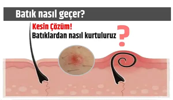 Genital Bölgedeki Batık İzleri Nasıl Giderilir, En Etkili Yöntemler Nelerdir