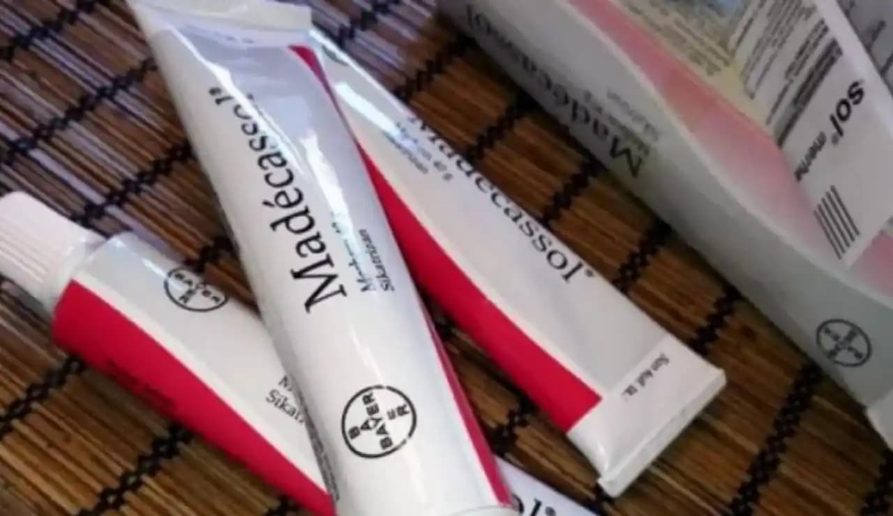 Genital Kaşıntısı İçin Güvenilir ve Etkili Merhem Seçenekleri ve Kullanım Yöntemleri