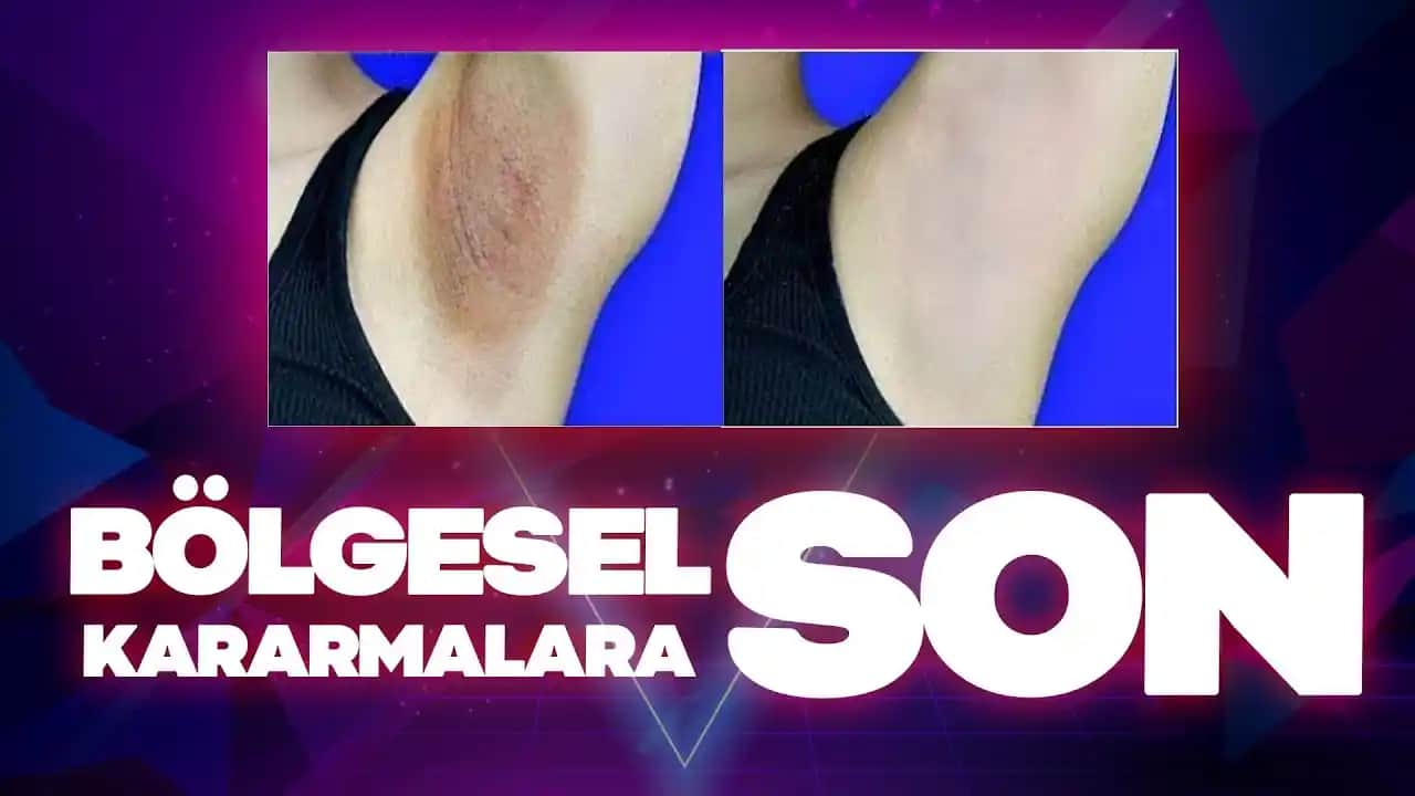 Genital ve Koltuk Altı Kararmalarını Azaltmak İçin Etkili Yöntemler ve Profesyonel Tedavi Seçenekleri