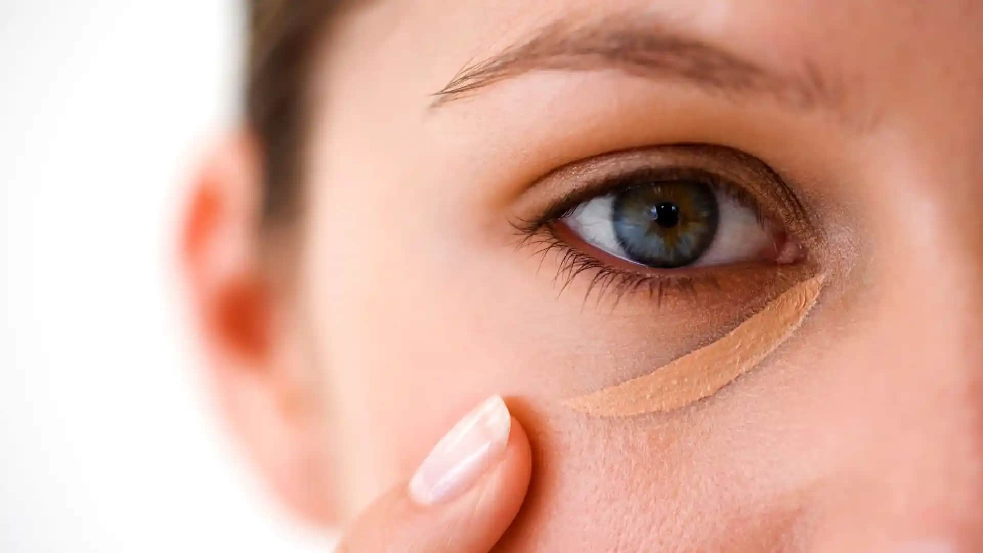 Göz Altı Komedonları Nasıl Geçer ve Cilt Sağlığını Koruma Yöntemleri