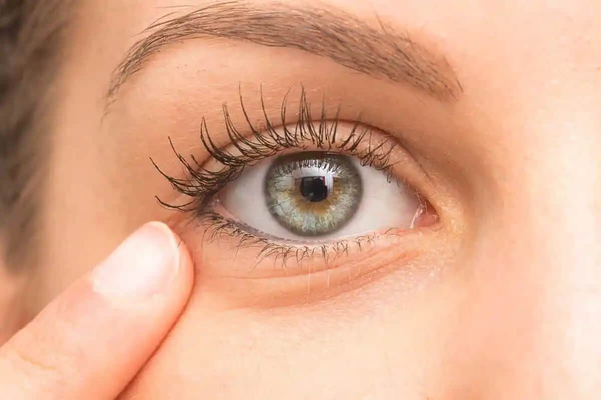 Göz Altı Morlukları Nasıl Geçer En Etkili Çözüm Yolları ve Bakım İpuçları