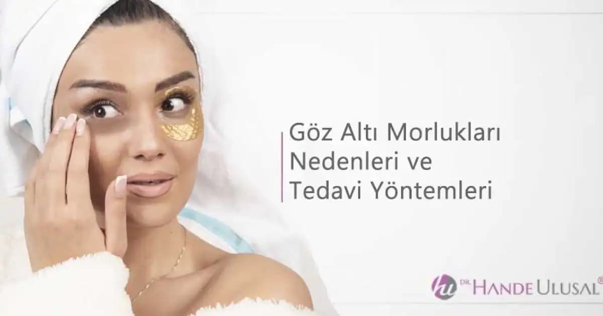 Göz Altı Morlukları ve Kızarıklıklarına Karşı Etkili Çözüm Yöntemleri ve Bakım İpuçları
