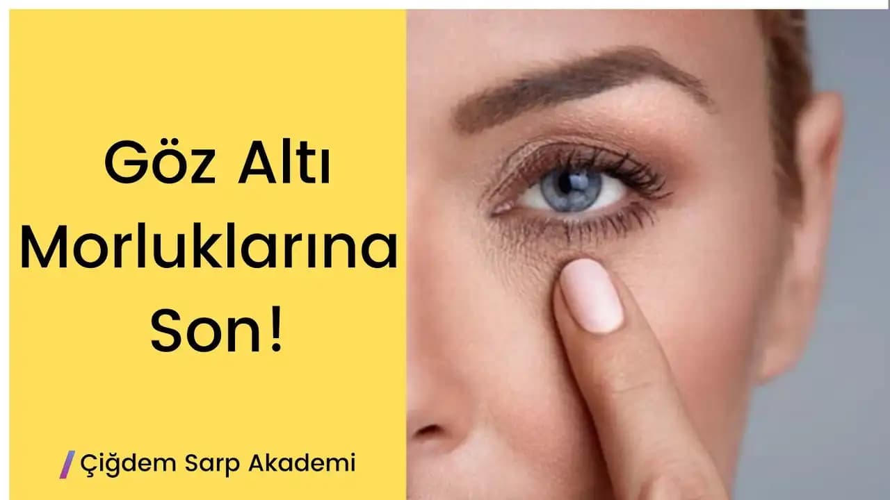 Göz Altı Morluklarını Gidermenin Etkili Yolları ve Günlük Bakım İpuçları