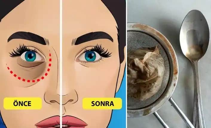 Göz Altı Şişliğini Azaltan Etkili Yöntemler ve Günlük Bakım Tavsiyeleri