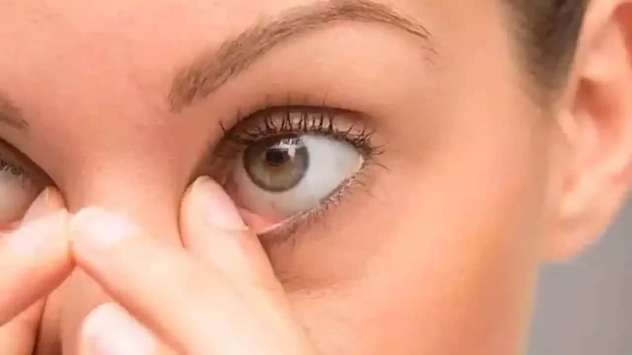 Göz Altı Siyahlığını Azaltmak İçin Etkili Yöntemler ve Doğal Çözümler