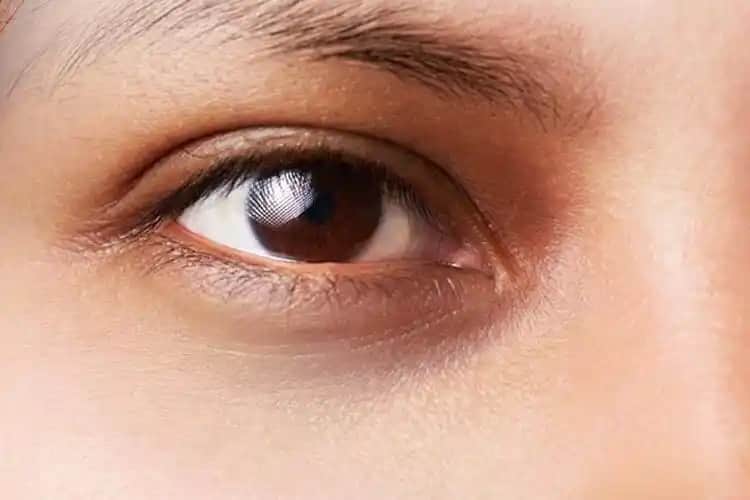 Göz Çevresi Neden Kararır ve Koruma Yöntemleri Hakkında Detaylı Bilgi