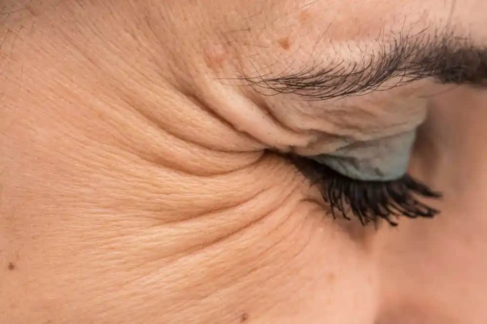 Göz Kazayağı Nedir ve Göz Çevresi İçin Etkili Bakım Yöntemleri Nelerdir