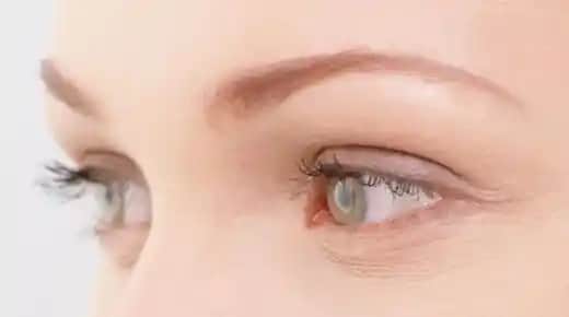 Gözaltı Kırışıklıklarına Karşı Etkili Çözümler ve Bakım Yöntemleri